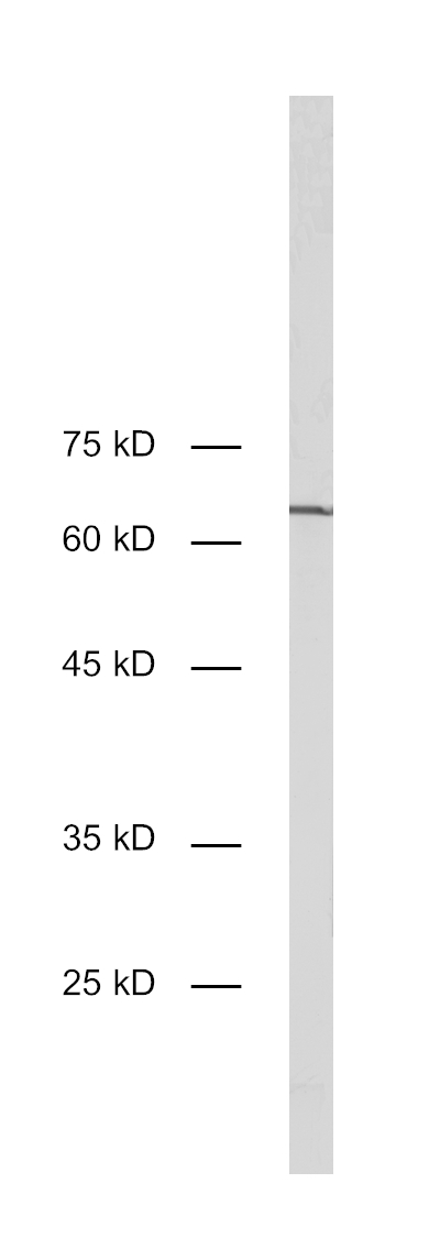 Dilution: 1&nbsp;:&nbsp;1000<br>Samples: Hela cell lysate<br>Observed MW: ~65 kD<br>Detection: AP staining<br><br>