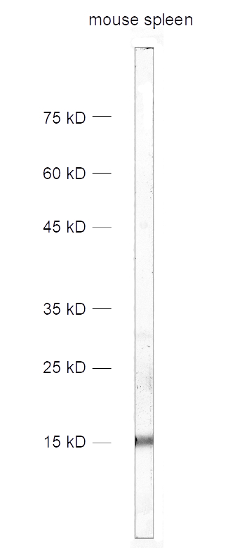 antibody dilution: 1&nbsp;:&nbsp;1000<br>samples: mouse spleen homogenate​